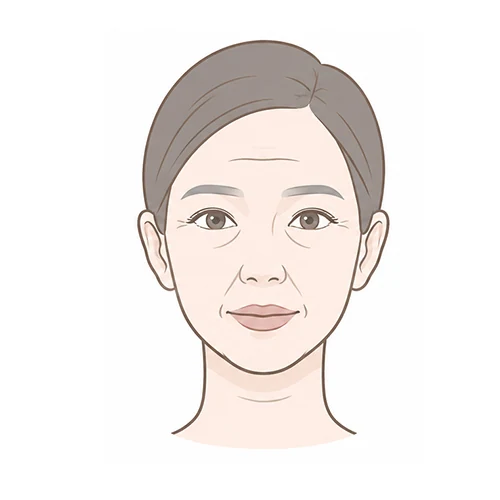 클립 스마스거상 — 최소절개 스마스 리프팅