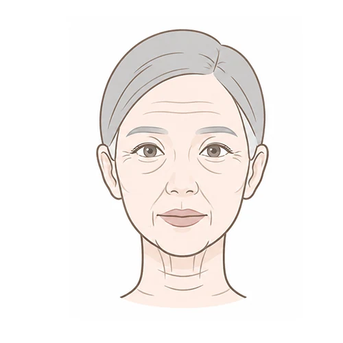 클립 풀 스마스거상 — 스마스 볼륨거상
